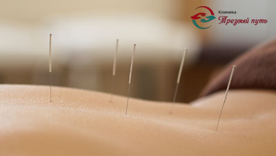 Спина с иглами