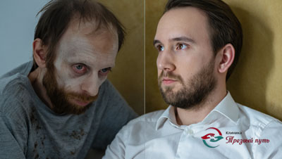 Картинка из двух частей- алкоголик до и после лечения